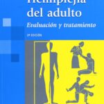 Hemiplejía del Adulto. Evaluación y Tratamiento.